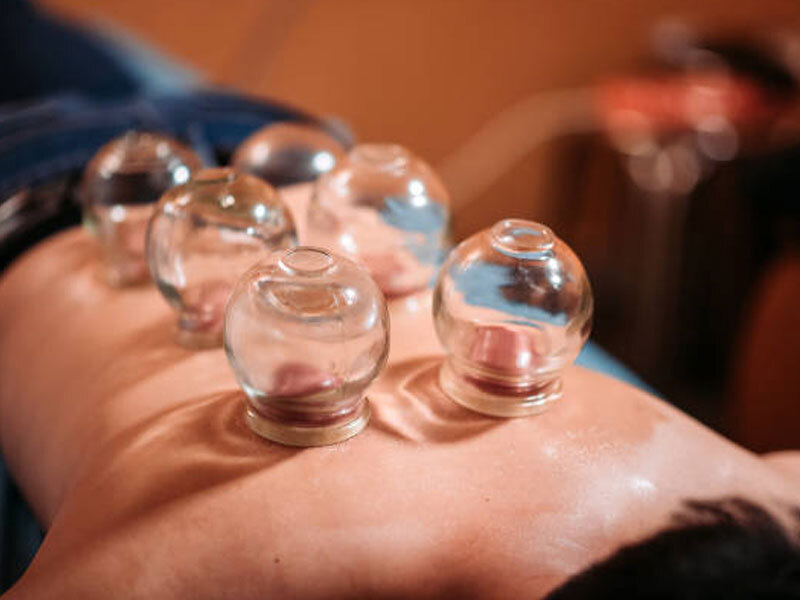 Benefits of Adelaide Traditional Cupping Therapy